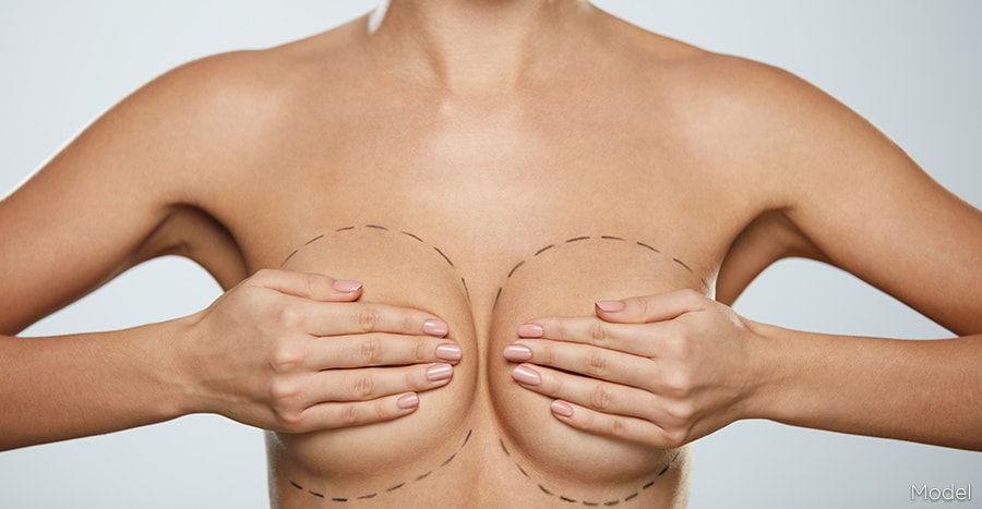 Enjoy the best prices when purchasing high-quality Breast implants Miami post thumbnail image